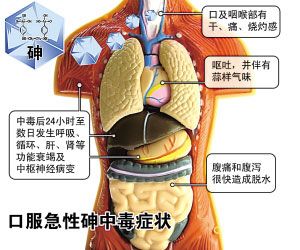砷中毒