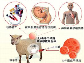 异种移植
