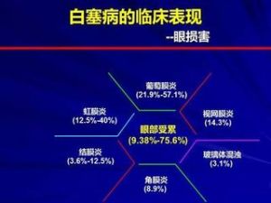 白塞病